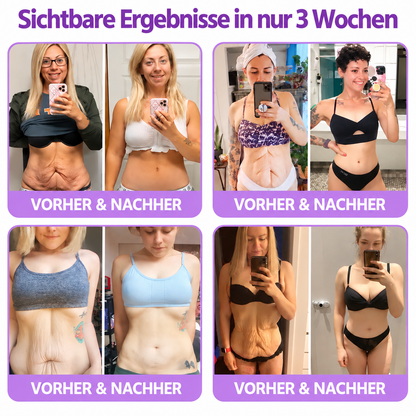 Natravor®🎗️ PDRN Multi-Peptid Straffende Körpercreme ｜ Anti-Aging Pflege, Feuchtigkeit, Straffung & Lifting für ein glatteres, ebenmäßigeres Hautbild｜