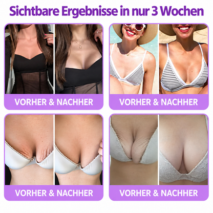 Natravor®🎗️ PDRN Multi-Peptid Straffende Körpercreme ｜ Anti-Aging Pflege, Feuchtigkeit, Straffung & Lifting für ein glatteres, ebenmäßigeres Hautbild｜