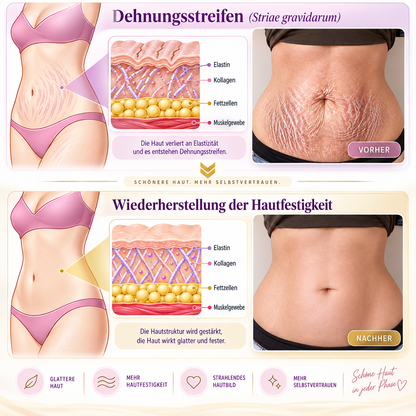 Natravor®🎗️ PDRN Multi-Peptid Straffende Körpercreme ｜ Anti-Aging Pflege, Feuchtigkeit, Straffung & Lifting für ein glatteres, ebenmäßigeres Hautbild｜