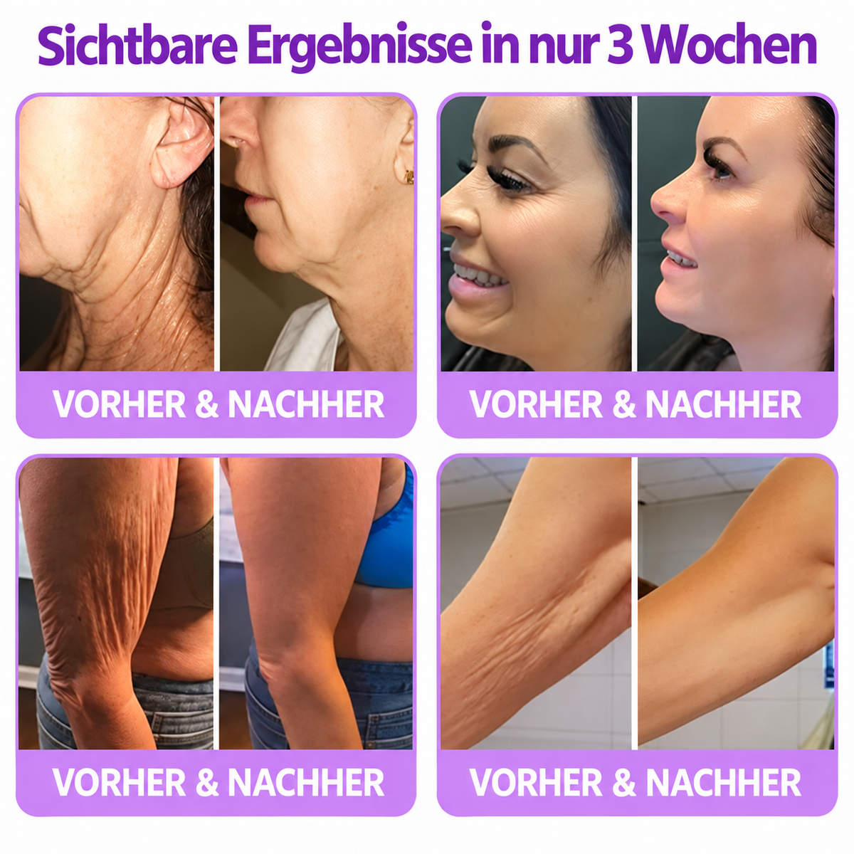 Natravor®🎗️ PDRN Multi-Peptid Straffende Körpercreme ｜ Anti-Aging Pflege, Feuchtigkeit, Straffung & Lifting für ein glatteres, ebenmäßigeres Hautbild｜
