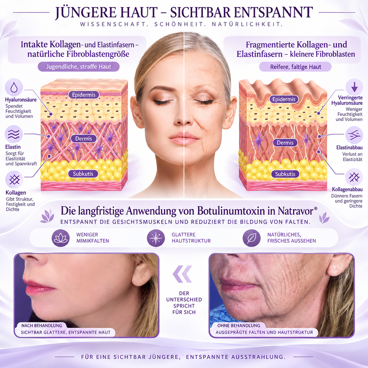 Natravor®🎗️ PDRN Multi-Peptid Straffende Körpercreme ｜ Anti-Aging Pflege, Feuchtigkeit, Straffung & Lifting für ein glatteres, ebenmäßigeres Hautbild｜