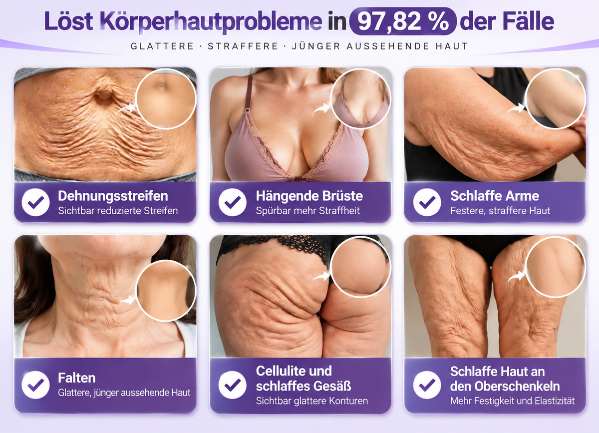 Natravor®🎗️ PDRN Multi-Peptid Straffende Körpercreme ｜ Anti-Aging Pflege, Feuchtigkeit, Straffung & Lifting für ein glatteres, ebenmäßigeres Hautbild｜