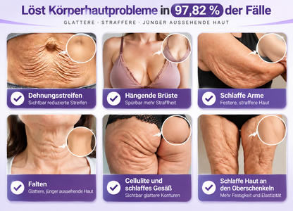 Natravor®🎗️ PDRN Multi-Peptid Straffende Körpercreme ｜ Anti-Aging Pflege, Feuchtigkeit, Straffung & Lifting für ein glatteres, ebenmäßigeres Hautbild｜